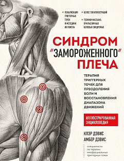 Синдром «замороженного» плеча. Терапия триггерных точек для преодоления боли и восстановления диапазона движений