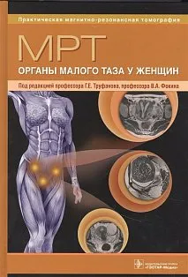 МРТ.Органы малого таза у женщин